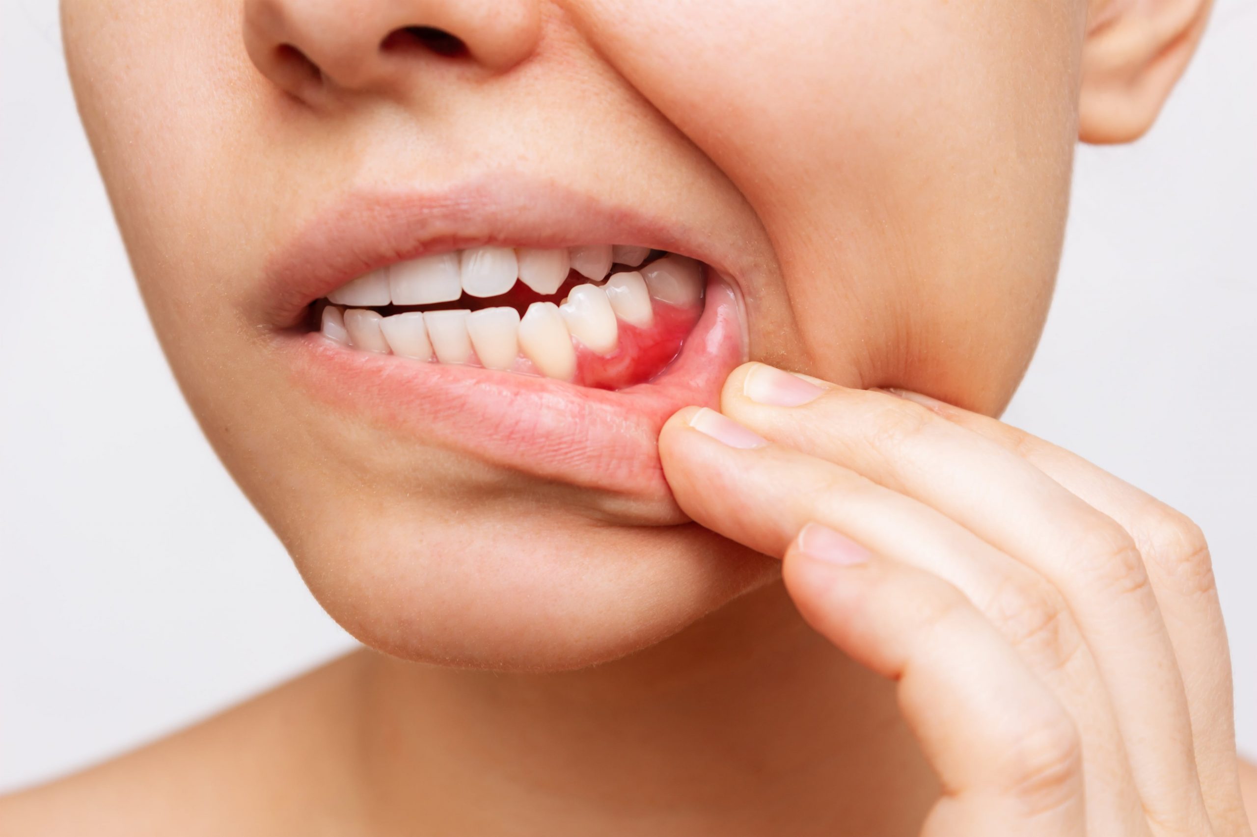 Keeping Your Gums Healthy: At-Home Practices