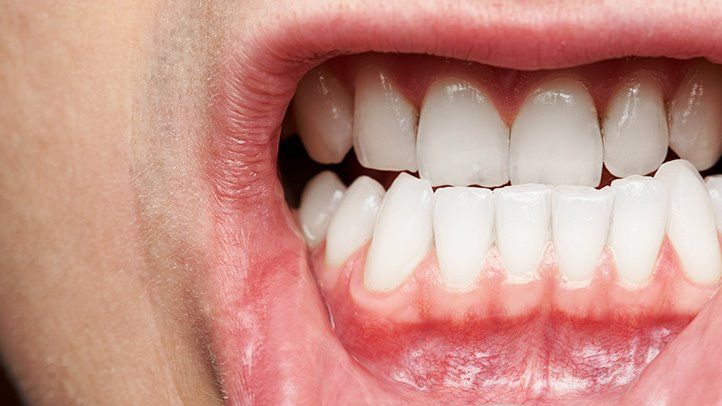 Nourishing Your Gums: A Fresh Take on Oral Health