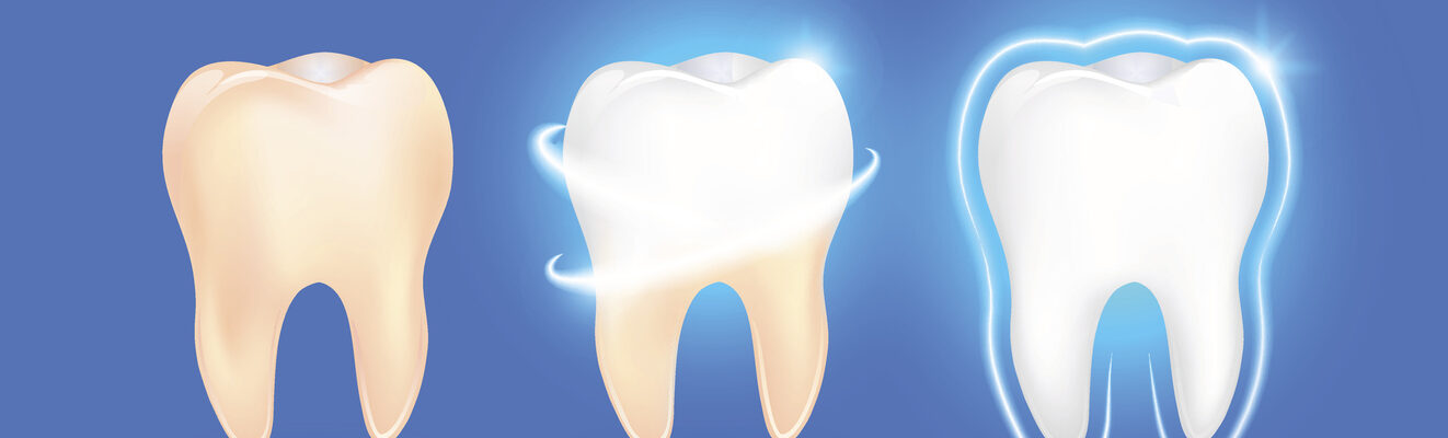 tooth enamel