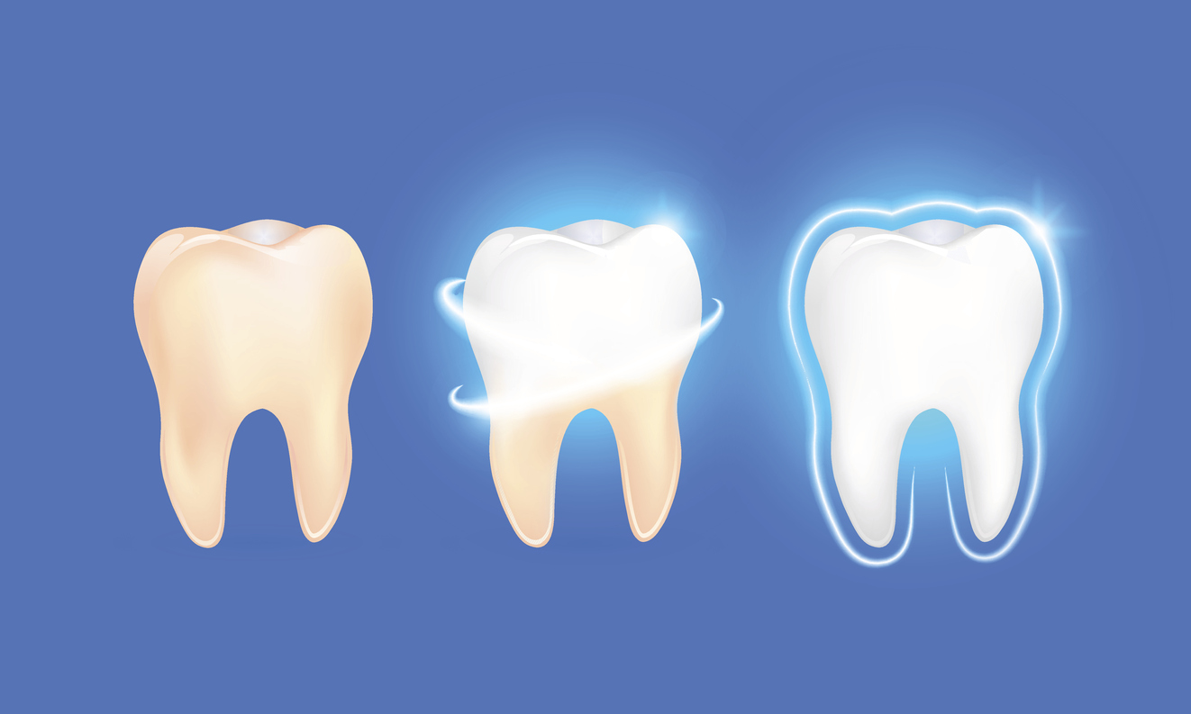 Tooth Enamel: Strategies to Fortify & Boost Your Smile