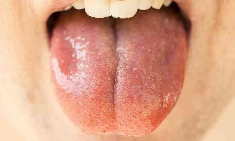 Saliva Key Role in Oral Health: More Than Just Wetness