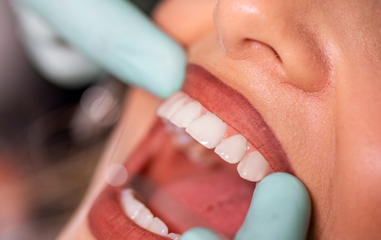 Raising Awareness on Oral Cancer: Keys to Early Spotting